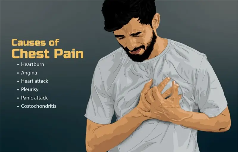 Costocondrită vs fibromialgie în formă tabulară